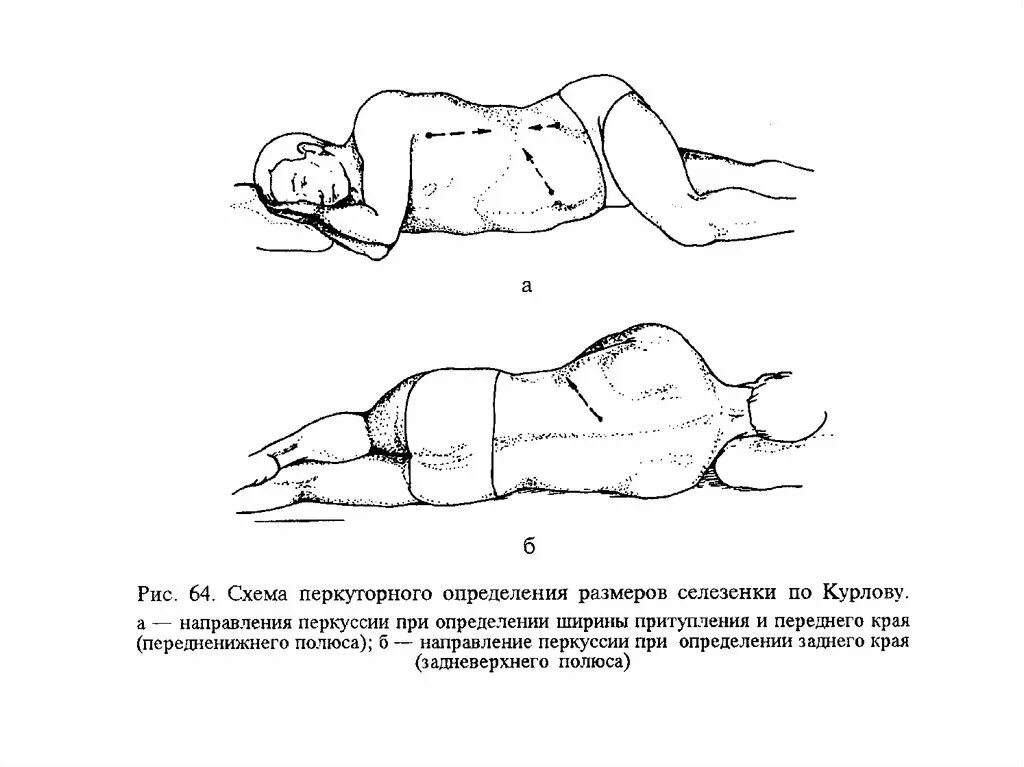 Определение размеров селезенки по курлову. Размеры селезенки по курлову. Методика перкуссии селезенки. Перкуссия селезенки в норме. Селезенка по курлову