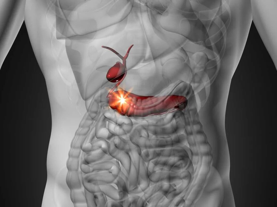 Боль в поджелудочной железе врач