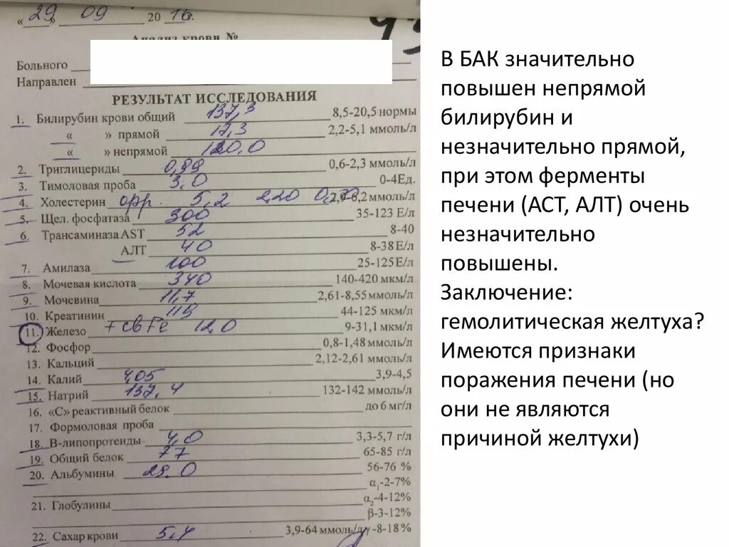 Билирубин повышен у взрослого мужчины причины. Анализ крови (прямой и непрямой билирубин норма. Билирубин общий и прямой повышен. Повышен общий и прямой Билли. Повышен общий билирубин в крови.