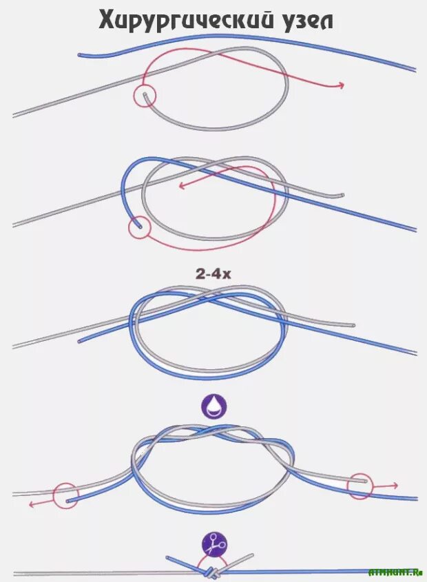 Рыболовные узлы хирургическая петля. Хирургическая петля на леске схема. Хирургическая петля для рыбалки схема. Хирургический узел для фидера. Как завязать шнурок на шее