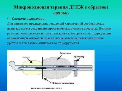 Метод микроволнового воздействия