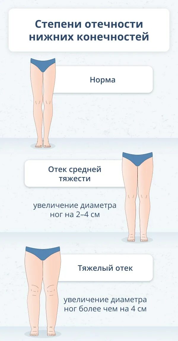 Как быстро избавиться от отека ног. От отёков ног препараты. народные средства при отеках ног. отёки ног причины у женщин.