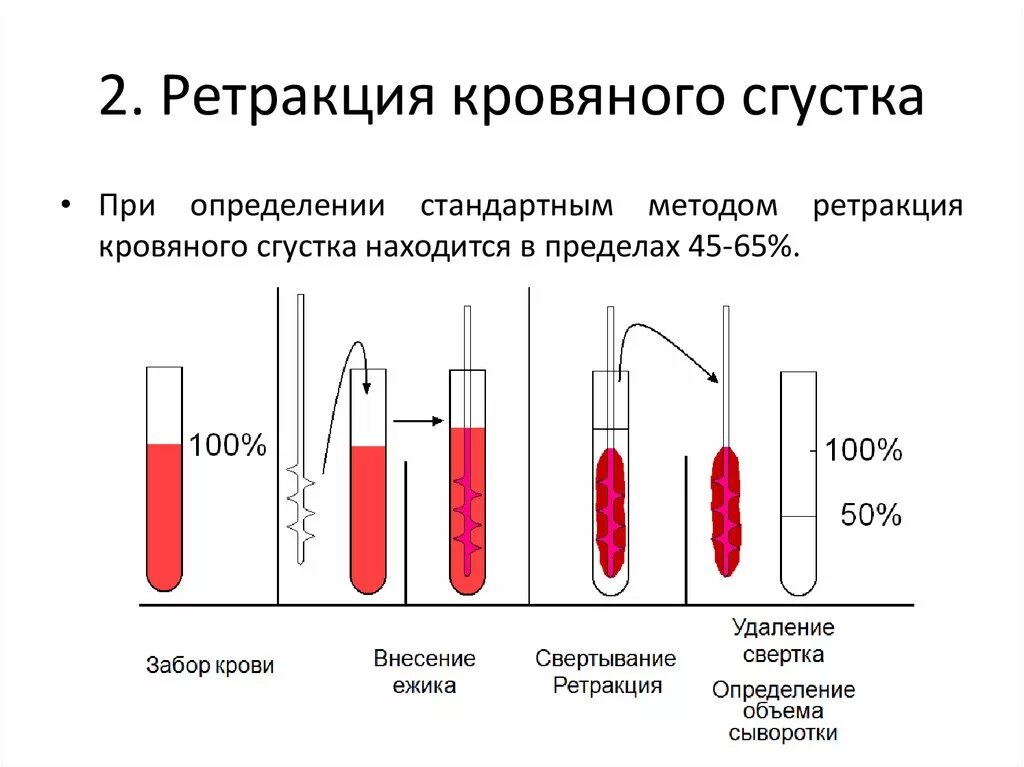 Почему кровь сворачивается при анализе. Норма ретракции кровяного сгустка. Оценка ретракции кровяного сгустка методика. Ретракция кровяного сгустка физиология. Ретракция тромбоцитарного сгустка.