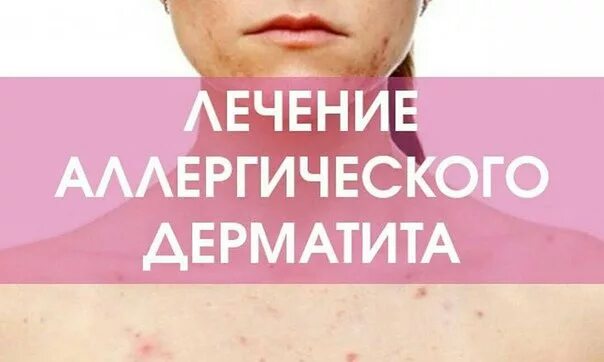 Атопический дерматит на лице у взрослых: фото, причины, симптомы и лечение