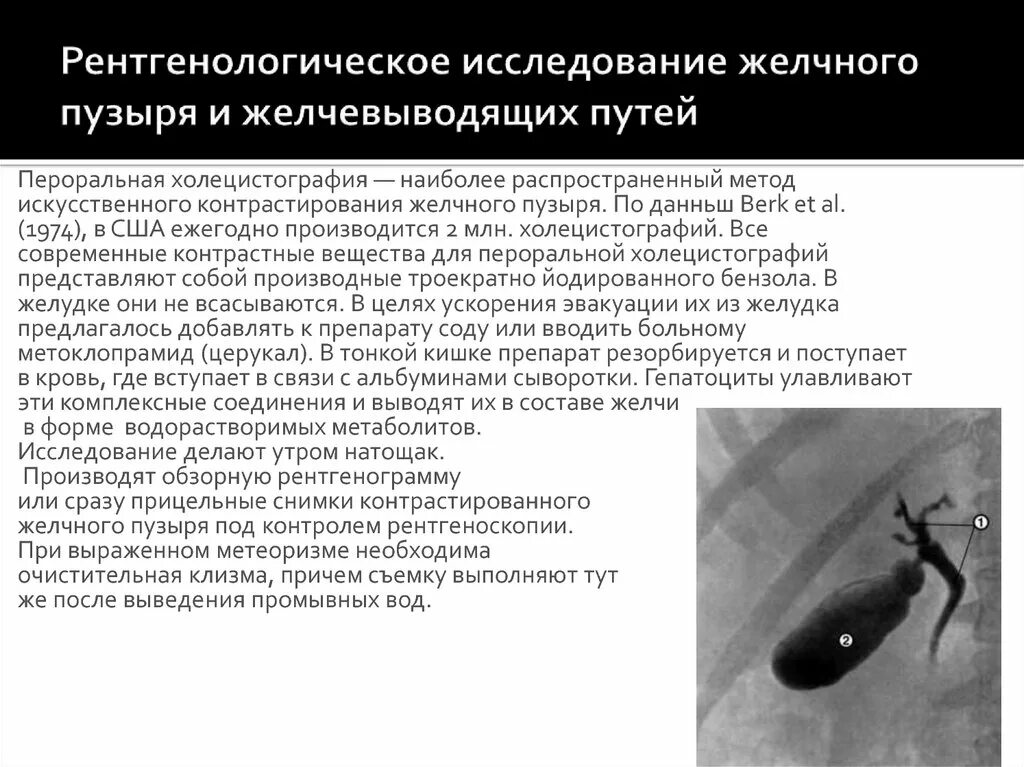 Способ желчного пузыря. Рентгенологические методы исследования желчного пузыря. Холецистография и холангиография. Методика исследования желчного пузыря и протоков. Рентген исследование желчного пузыря.