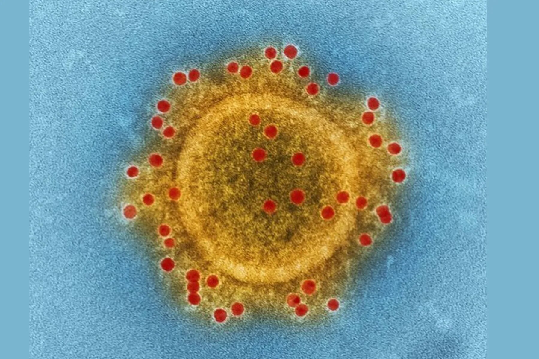 Коронавирус основные. Вирус mers-cov. Клро. Коронавирус.