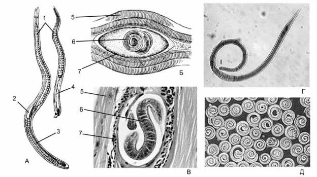 Трихинелла Спиралис цикл. Строение личинки трихинеллы в мышцах. Трихинелла Спиралис строение личинки. Трихинелла спиральная личинка.