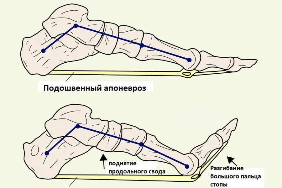 Подошвенный фасциит что это такое. Подошвенный (плантарный) фасциит. Подошвенная фасция стопы анатомия. Апоневроз стопы анатомия. Подошвенный фасциит свода стопы.