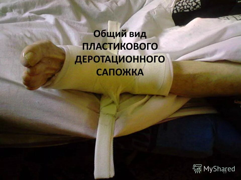 Выздоровление после перелома. Выздоровление после перелома