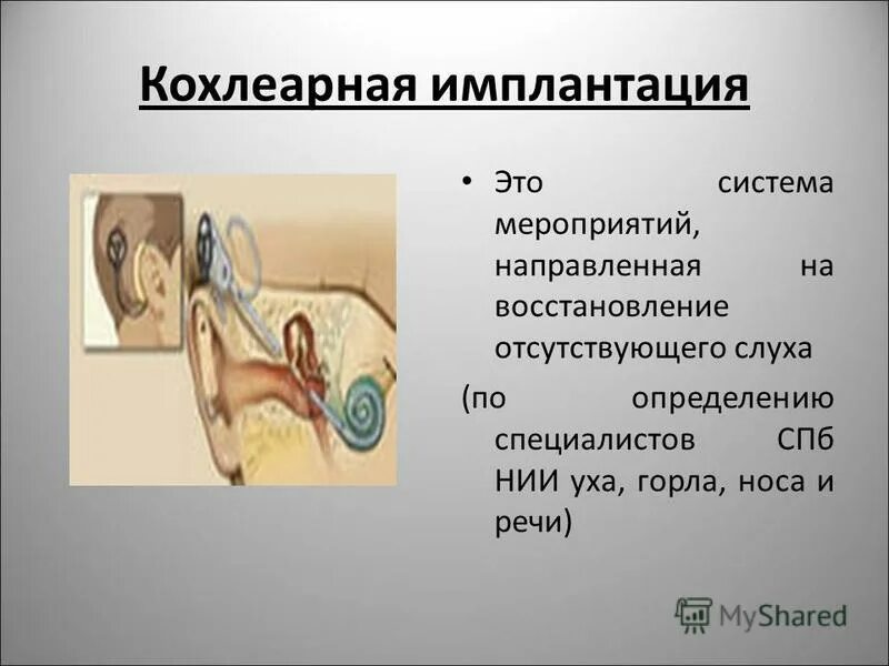 система кохлеарной имплантации. операция по кохлеарной имплантации. принцип работы кохлеарного импланта. аппарат слуховые аппараты при тугоухости 3. кохлеарный слуховой аппарат анатомия.