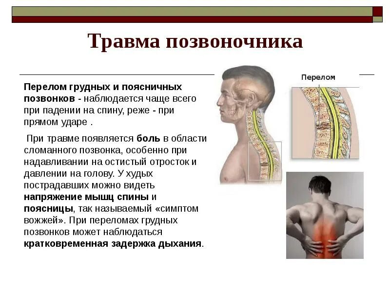 Сотрясение позвоночника. Поврежденияпозвоночник. Травма позвоночника, спины. Закрытая травма позвоночника.