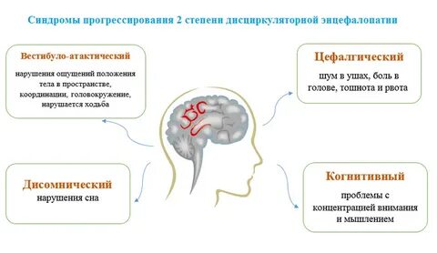 Вестибуло атактический синдром лечение