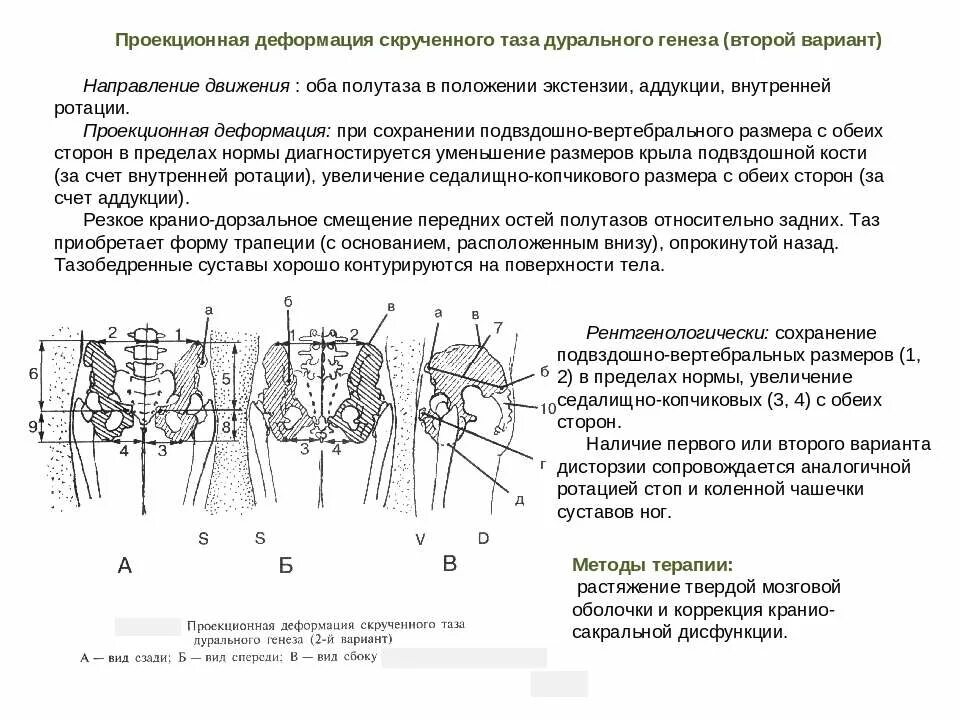 Деформация костей таза. Причины ротации таза. Перекос таза причины. Перекос скручивание таза.