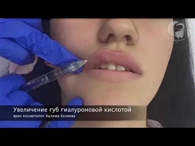 Увеличение головки