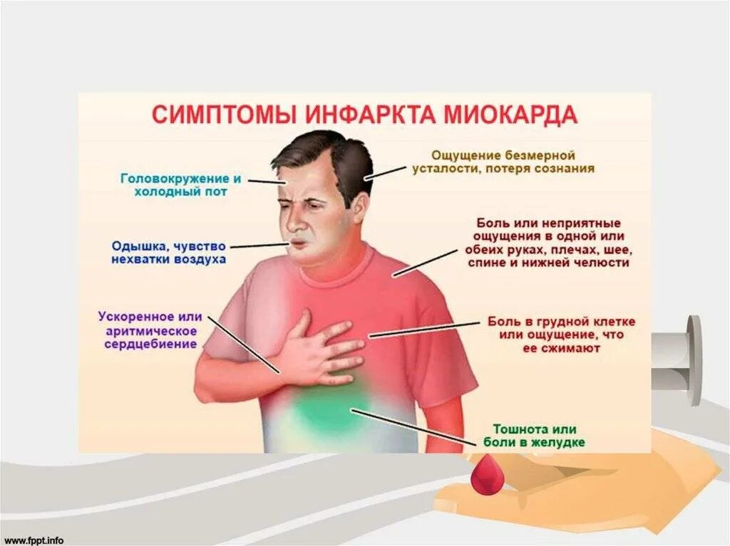 Клинические проявления инфаркта миокарда. Клинические симптомы инфаркта миокарда. Причины боли в грудной клетке у мужчин посередине спереди. Боль в центре грудной клетки спереди. Симптомы микроинфаркта у женщин