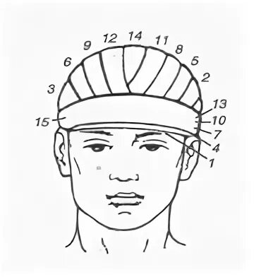 Повязка шапочка гиппократа техника наложения. Чепец Гиппократа повязка. Чепец и шапочка Гиппократа. Перевязка шапочка Гиппократа. Шапочка Гиппократа повязка техника наложения.