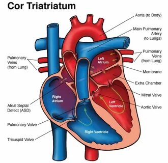 Cor triatriatum causes, symptoms, diagnosis, treatment & prognosis.