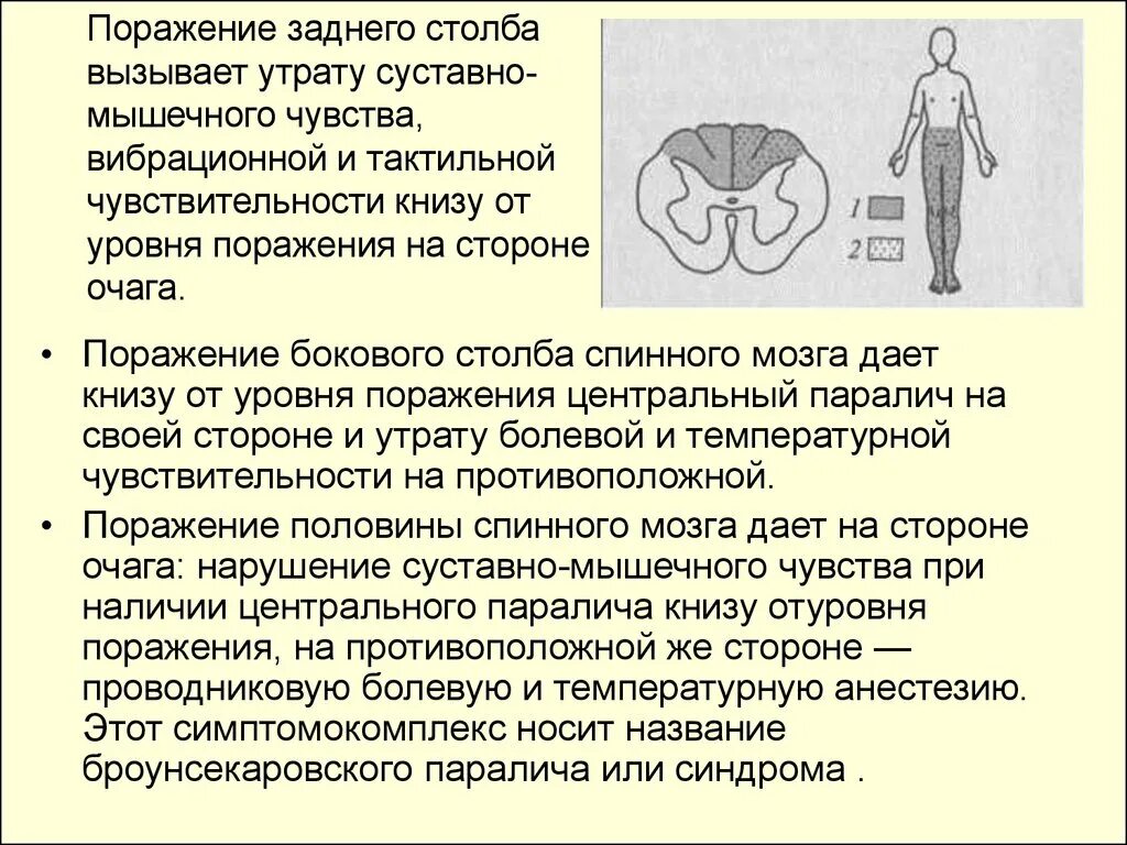 Поражение задних столбов спинного мозга. Поражение бокового столба спинного мозга. Синдром поражения задних столбов спинного мозга. Поражение задних столбов спинного мозга симптомы. Центр мышечного чувства