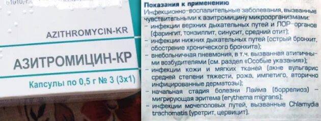 При фарингите нужно пить антибиотики. Антибиотики при ангине азитромицин. таблетки от ангины с антибиотиком азитромицин. коронавирус антибиотик азитромицин. антибиотики от ангины взрослым азитромицин.