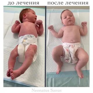 Ребенок постоянно кряхтит