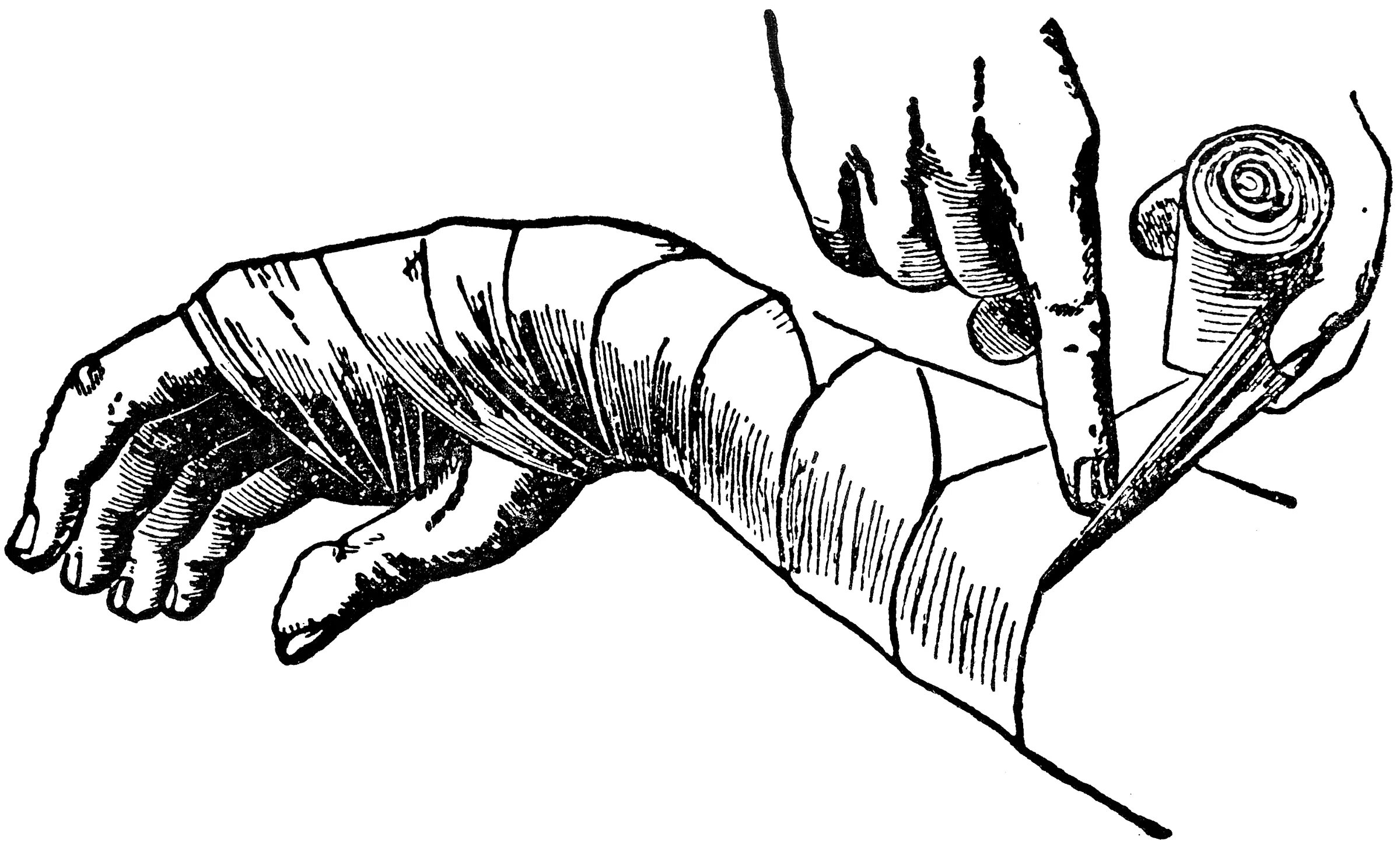 Наложение повязок на раны. Перевязка РАН В средневековье. Картинку перевязаны