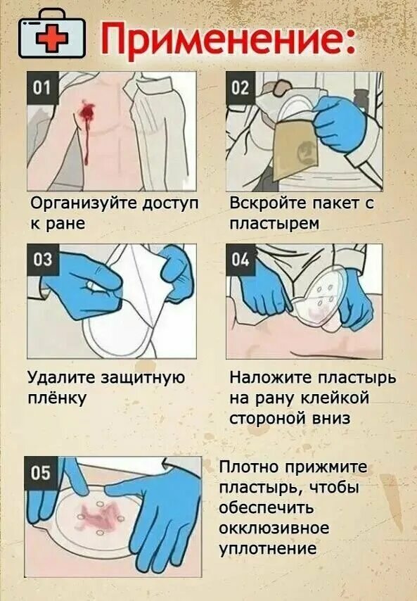 Окклюзионный пластырь chest seal. Окклюзионные повязки что это простыми. Окклюзионная повязка при открытом пневмотораксе. Окклюзионная повязка при пневмотораксе алгоритм. Пневмоторакс окклюзионная повязка.