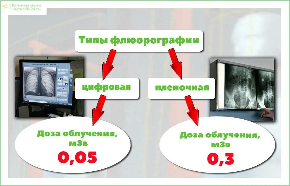 Сколько раз делают флюорографию в год взрослым. Цифровая флюорография. Пленочная и цифровая флюорография. Цифровая флюорография снимок. Методики цифровой флюорографии.