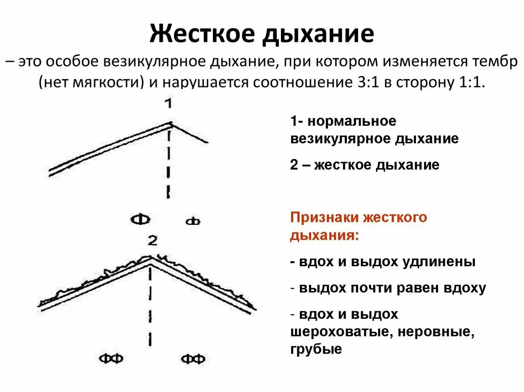 Что значит жесткие легкие. Основные дыхательные шумы схема. Везикулярное дыхание схема. Схема жесткого везикулярного дыхания. Жесткое дыхание.