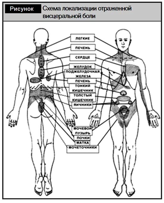 Схема боли в спине. Локализация боли в спине. Локализация ьоливспине. Локализация боли при различных заболеваниях. Локализация болей в спине схема.