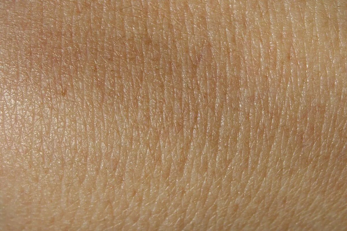 Usa estos ingredientes para cerrar los poros de tu cara instantaneamente Puntos 