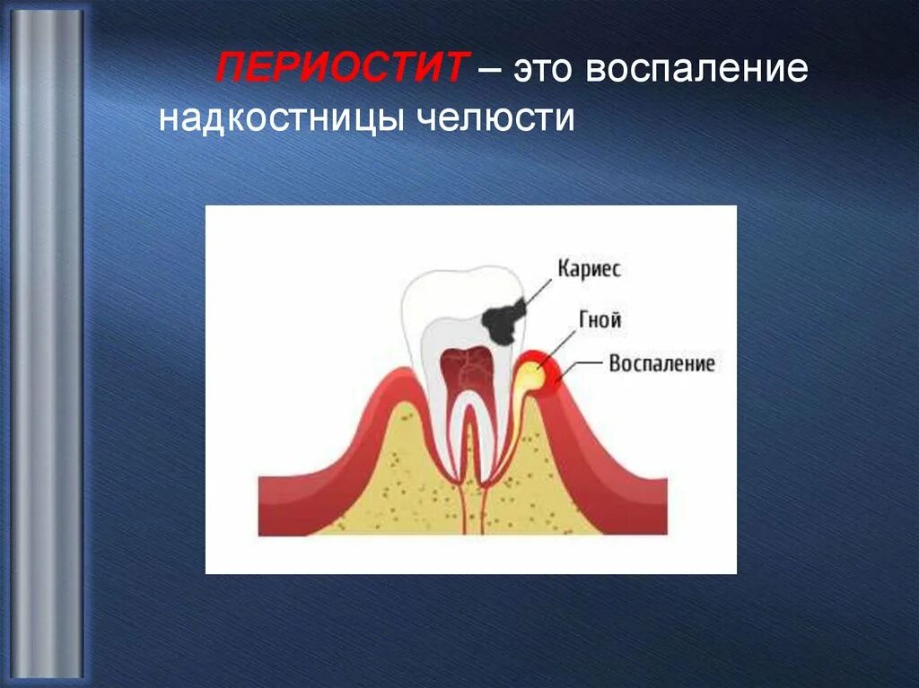 Альвеолярная десна. Надкостница альвеолярного отростка. Строение надкостницы челюсти. Надкостница зуба строение.