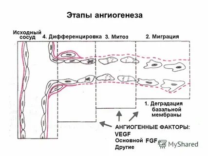 Ангиогенез
