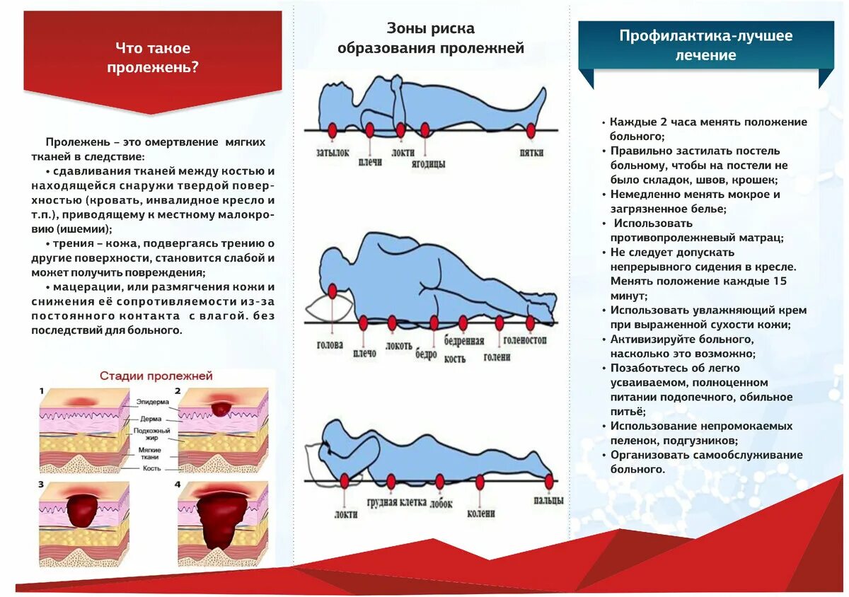 Профилактика пролежней памятка. Пролежни у тяжелобольных пациентов профилактика пролежней. Памятка профилактика пролежней для пациента. Памятка пролежни буклет.