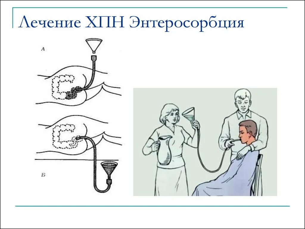 Энтеросорбция. Лечение ХПН. Энтеросорбция это в медицине. Хроническая почечная недостаточность лечение.