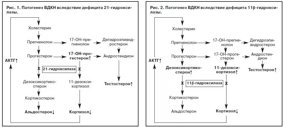адреногенитальный синдром клинические рекомендации. адреногенитальный синдром клинические рекомендации. адреногенитальный синдром частота. патогенез врожденного адреногенитального синдрома. адреногенитальный синдром симптомы частота.