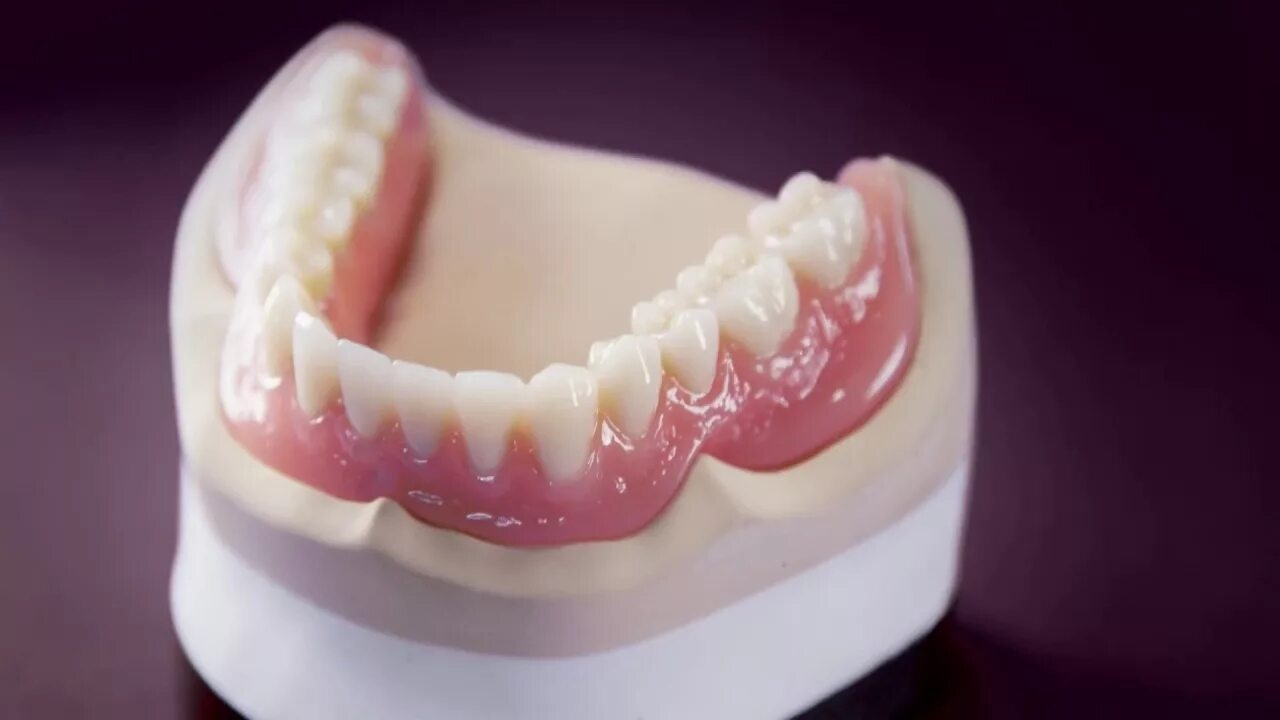 виниловые съемные протезы. виниловые протезы. бюгельный протез quattro ti. силиконовые зубные протезы. виниловый протез зубов.