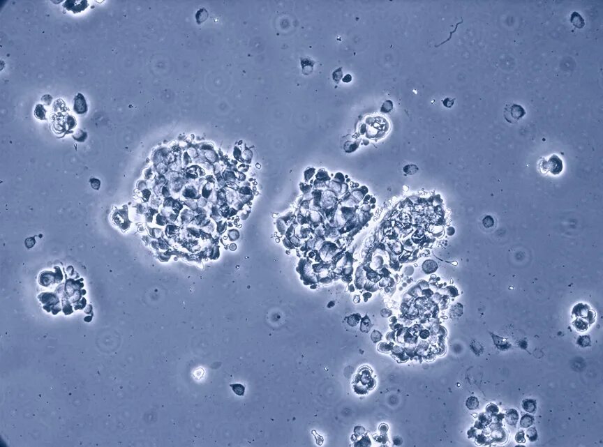 Chlamydia trachomatis mycoplasma genitalium. Клетки MCF 7. Микоплазма микробиология. Микоплазма в культуре клеток.