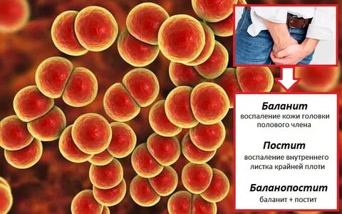 Открытая половая головка