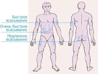 Можно колоть гормон роста. Места инъекций инсулина. Места введения инсулина в живот. Зоны инъекций инсулина в живот. Места введения инсулина картинки.