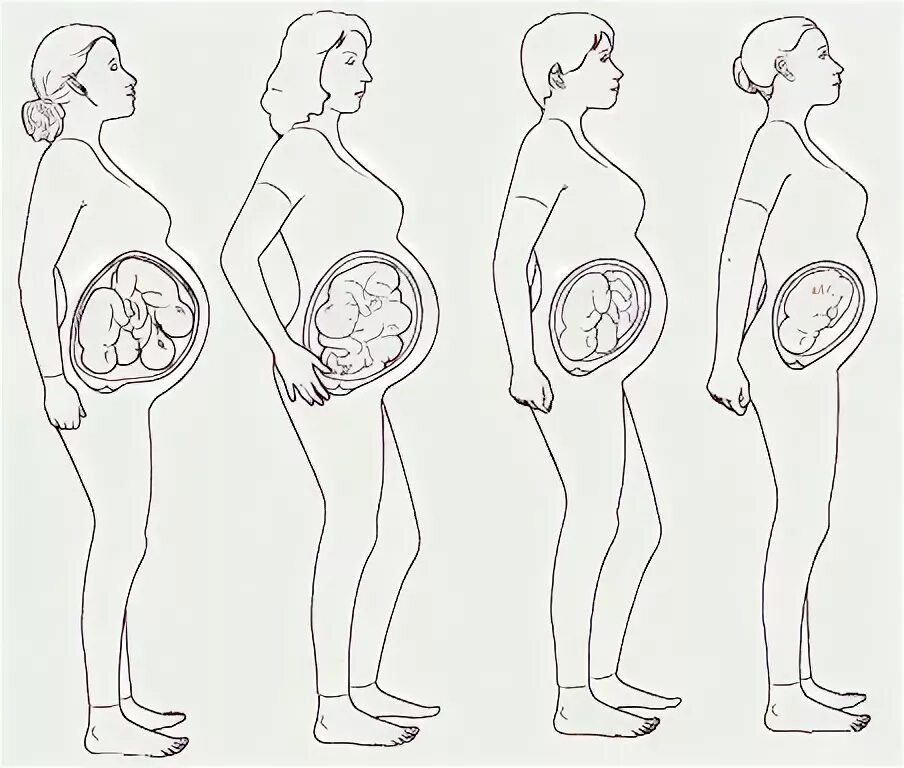 9 месяц беременности роды. Расположение малыша в животе. Расположение плода по неделям. Расположение ребенка в животе по неделям. Расположение плода в утробе по неделям.