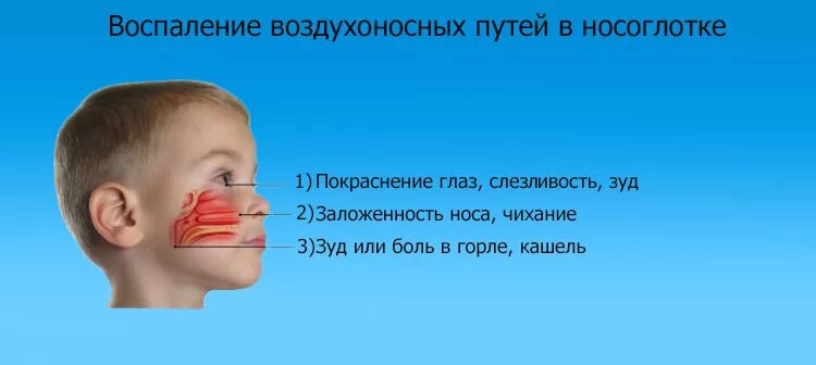 Заложенность носа у ребенка 3 года. Массаж носа при заложенности у ребенка. Массаж от насморка и заложенности у ребенка. Точки от заложенности носа у детей. Точечный массаж при заложенности носа у детей.