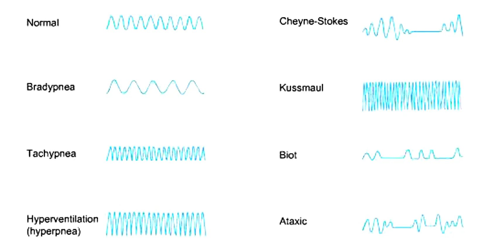 1 редкое дыхание. Дыхание Биота и Чейна Стокса. Типы дыхания Куссмауля Чейна Стокса Биота. Патологическое дыхание Куссмауля Чейна-Стокса. Виды дыхания.