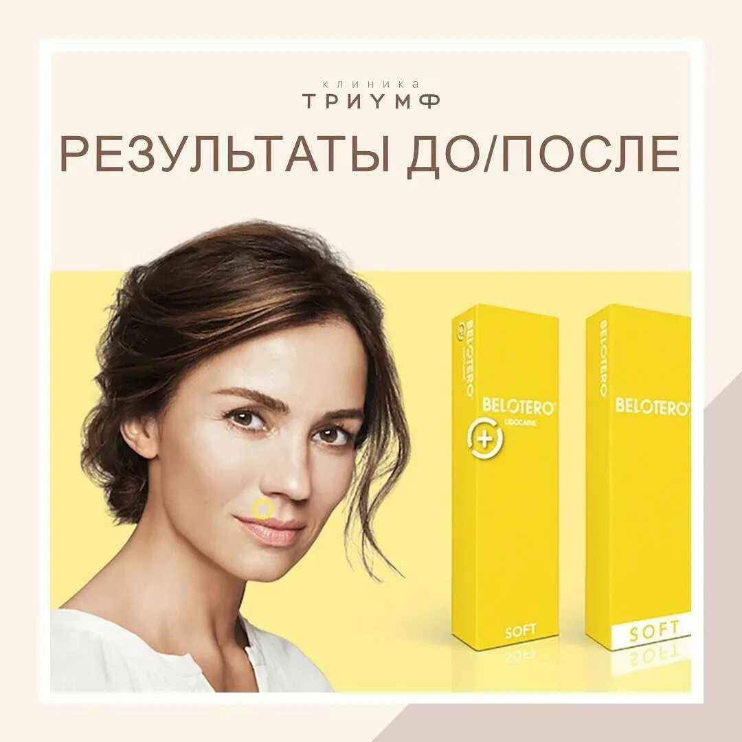 Белотеро филлеры астрея. Belotero Soft 1.0 ml (Швейцария). Belotero Hydro Швейцария 1.0 мл. Бланширование препаратом Belotero Soft. Филлеры для лица Белотеро софт.