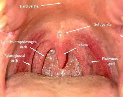 Mouth Throat Exam Osce. simpleosce.com. 