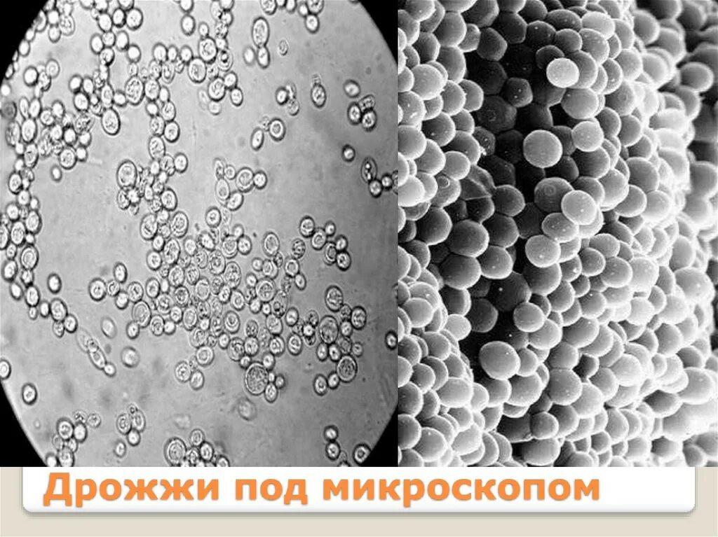 Дрожжи под микроскопом строение Yeast under Bright field microscope A summary of different types of microscope M