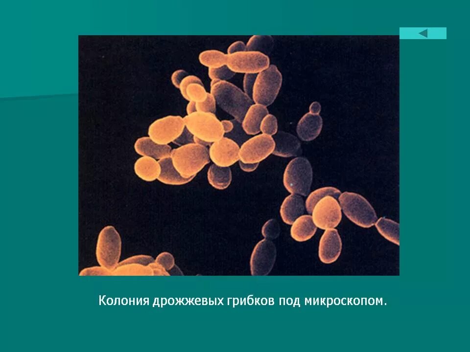 Дрожжи живые организмы. Бактерии сапрофиты дрожжи. Клетки дрожжей под микроскопом. Дрожжевые грибки под микроскопом. Пекарские дрожжи под микроскопом.