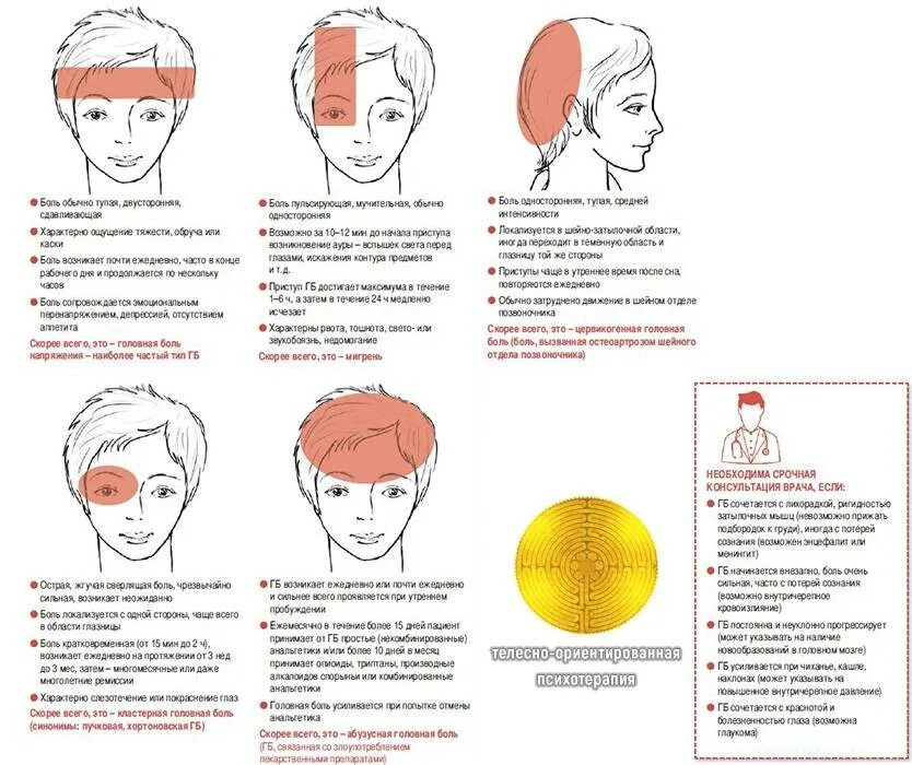 У подростка болит голова что делать. Виды головной боли. Вилюды, головной боли. Схема боли в голове. Типы головной боли и причины.