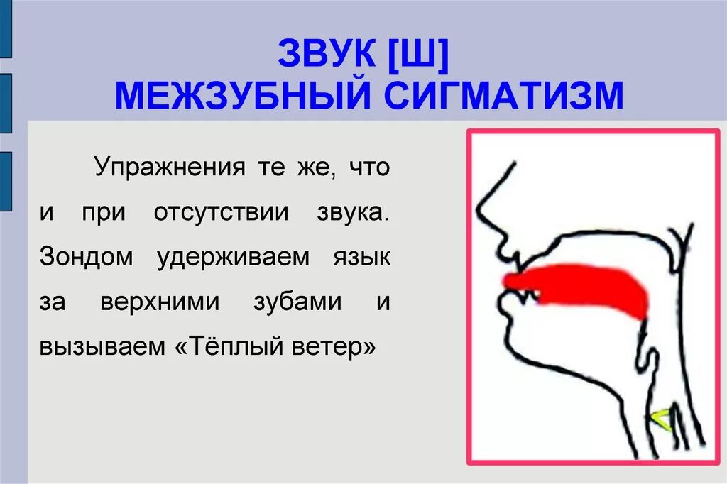 Межзубный сигматизм шипящих звуков. Межзубный сигматизм постановка звука с. Постановка межзубного звука ш. Межзубный сигматизм упражнения. Ш как произносится