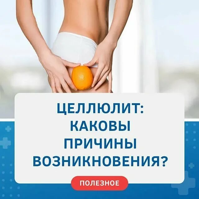 Целлюлит причины. Целлюлит причины возникновения. Факторы развития целлюлита. Причины появления целлюлита. Целлюлит причины возникновения.