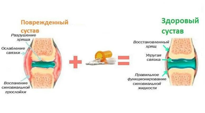 Механизм действия хондропротекторов. Механизм действия хондроитина сульфата. Уколы для восстановления суставного хряща. Регенерация и восстановление суставного хряща.